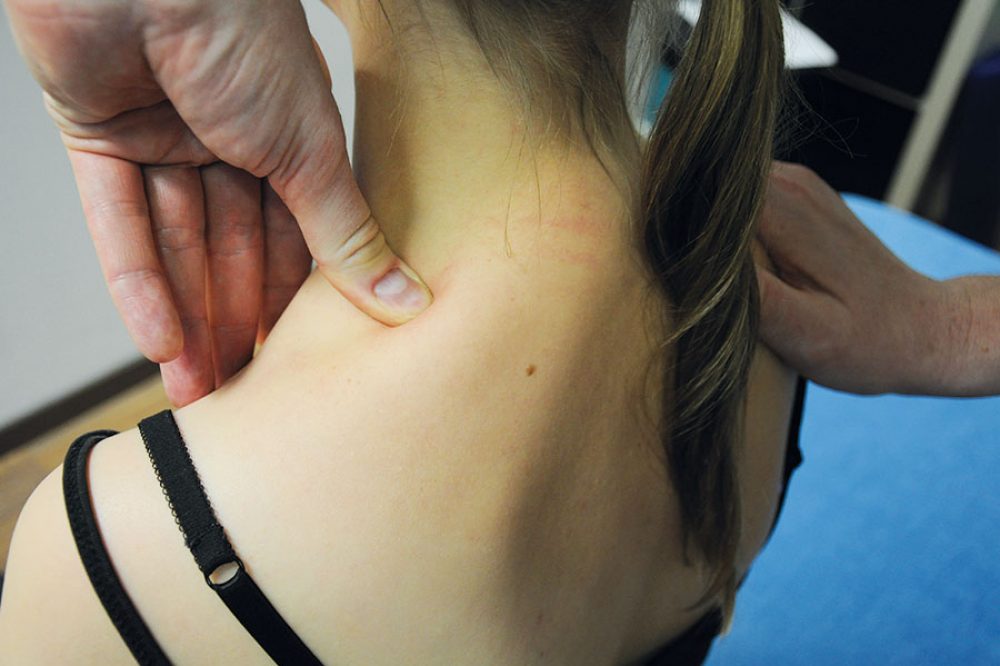 FDM n S. Typaldos Fasziendistorsionsmodell